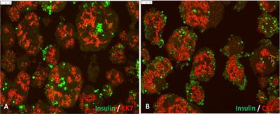 Multipotent Mesenchymal Stromal Cells Interact and Support Islet of Langerhans Viability and Function